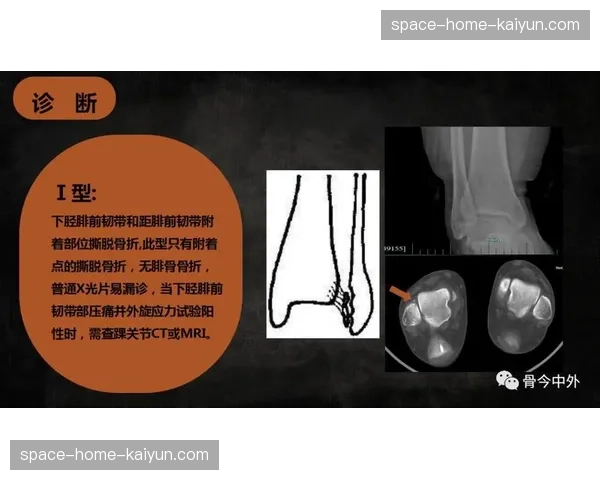 丹麦女单主力米娅宣布因脚踝应力性骨折，将缺席欧洲锦标赛